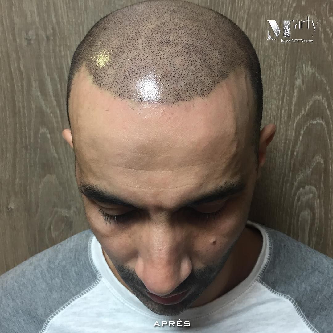 efficacité soin cheveux botox