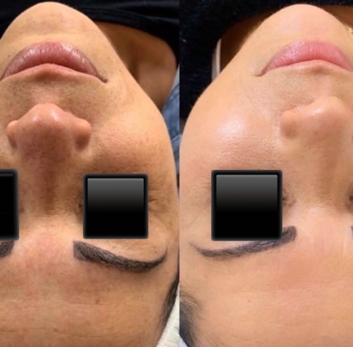 institut soin visage Lyon