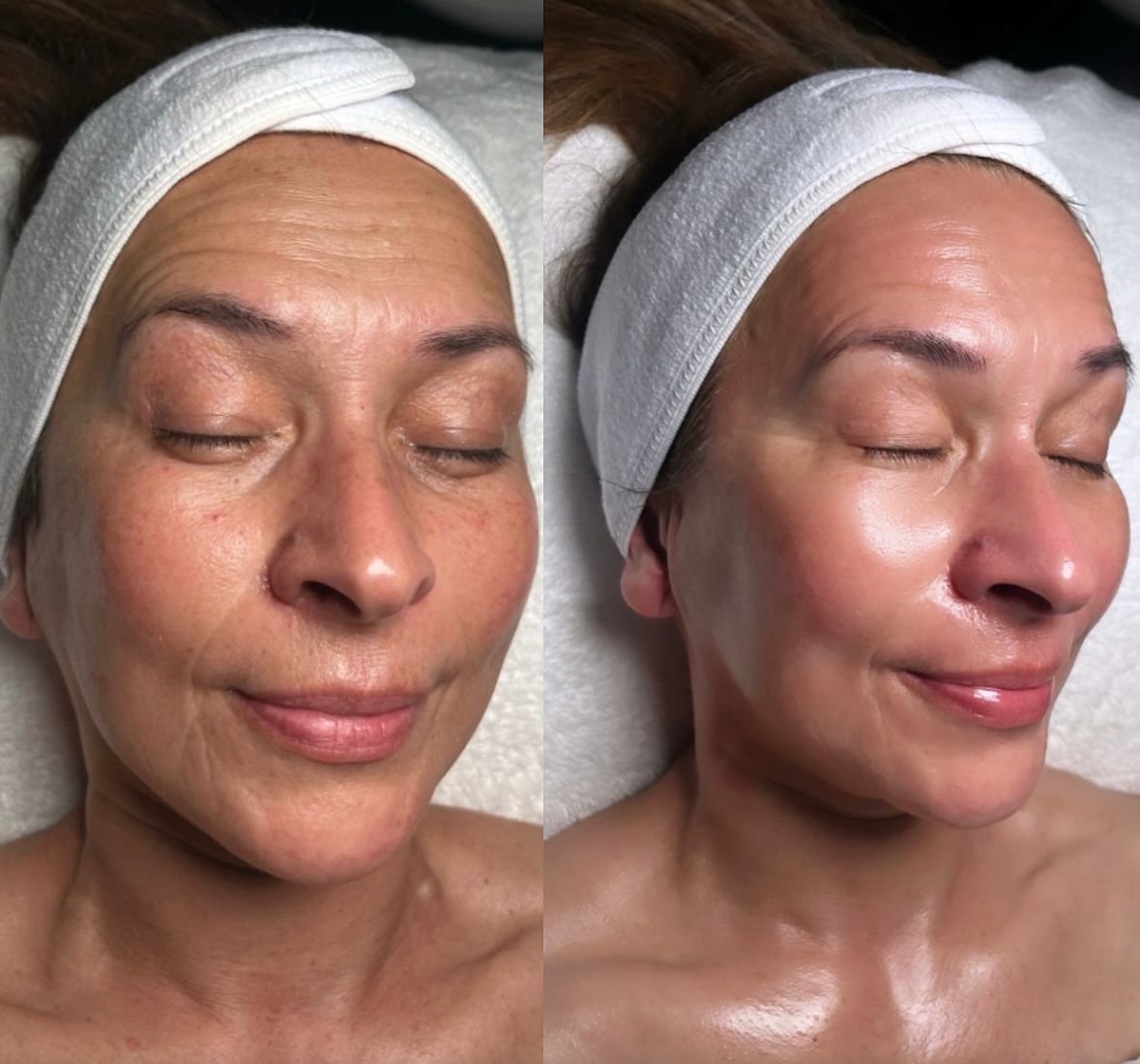 institut soin visage Lyon