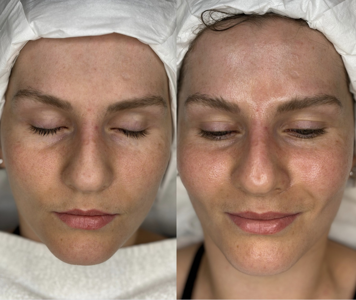 institut soin visage Lyon