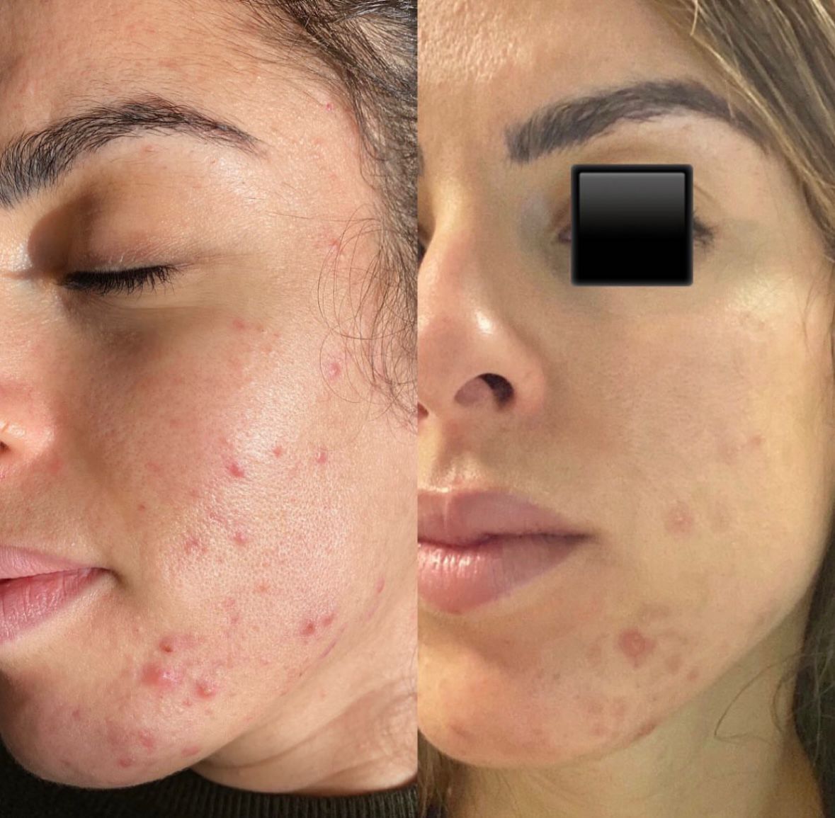 institut soin visage Lyon