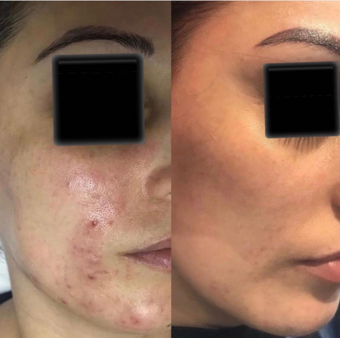 institut soin visage Lyon