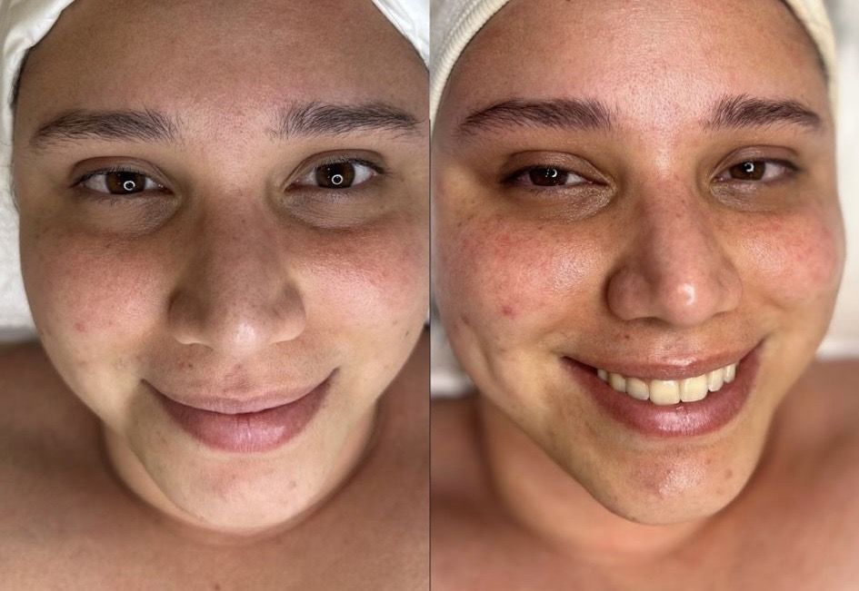 meilleur soin visage Lyon